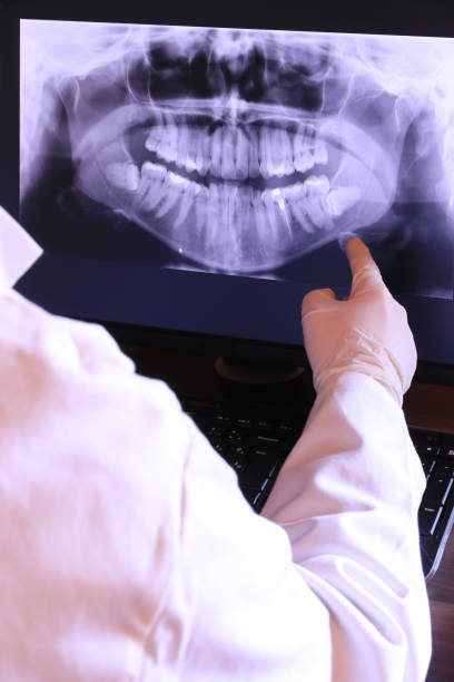 Best Emergency Denture Repair in Reading, OH